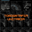 Tomografía unitaria